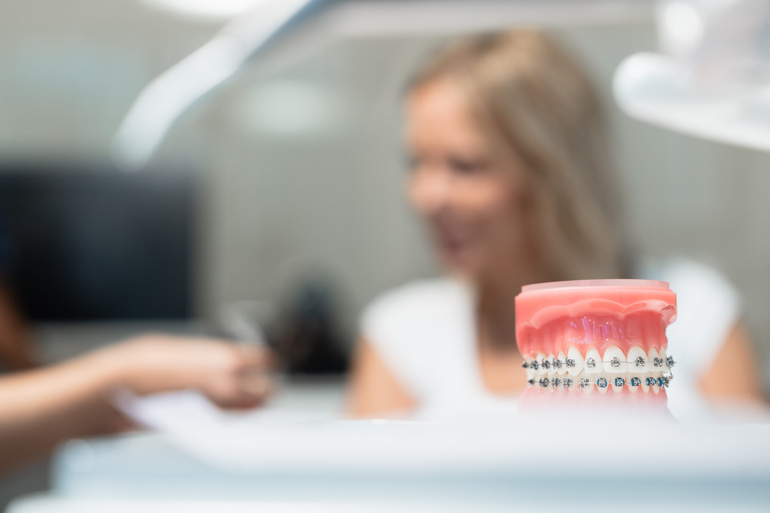 Modèle dentaire avec appareil orthodontique